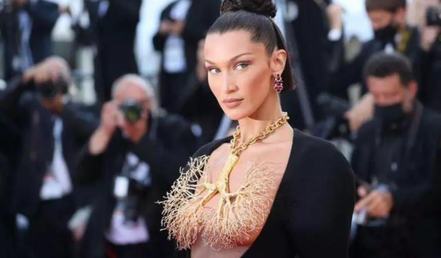 Dünyaca ünlü model Bella Hadid hastalığını itiraf etti: Her gün acı çekiyor…